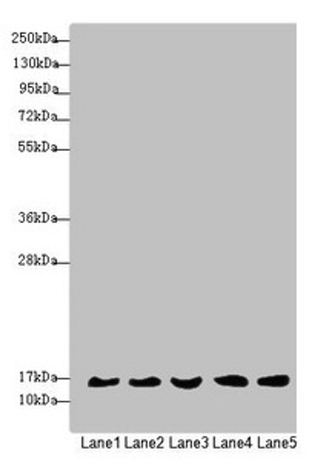 Western blot. All lanes: MRPS16 antibody at 1.35µg/ml. Lane 1: Mouse liver tissue. Lane 2: 293T whole cell lysate. Lane 3: Jurkat whole cell lysate. Lane 4: Raji whole cell lysate. Lane 5: HepG2 whole cell lysate. Secondary. Goat polyclonal to rabbit IgG at 1/10000 dilution. Predicted band size: 16, 14 kDa. Observed band size: 16 kDa