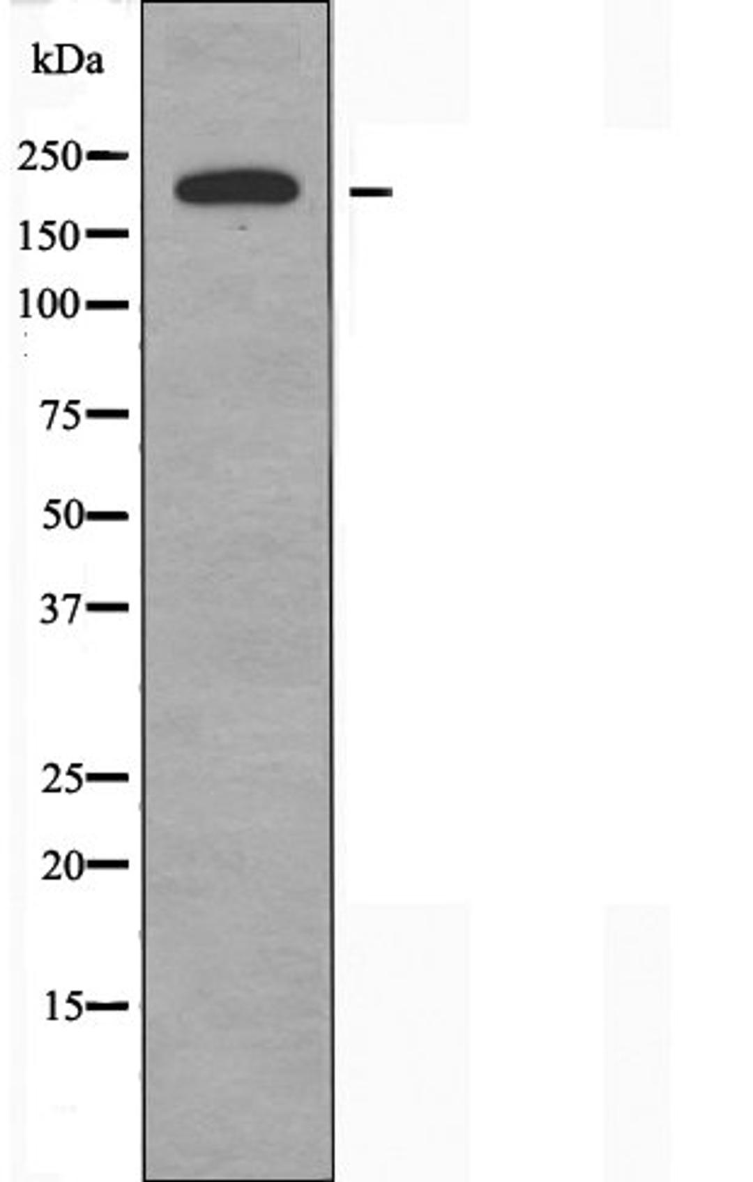 Western blot analysis of Hela cells using Collagen V Alpha1 antibody