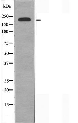 Western blot analysis of Hela cells using Collagen V Alpha1 antibody