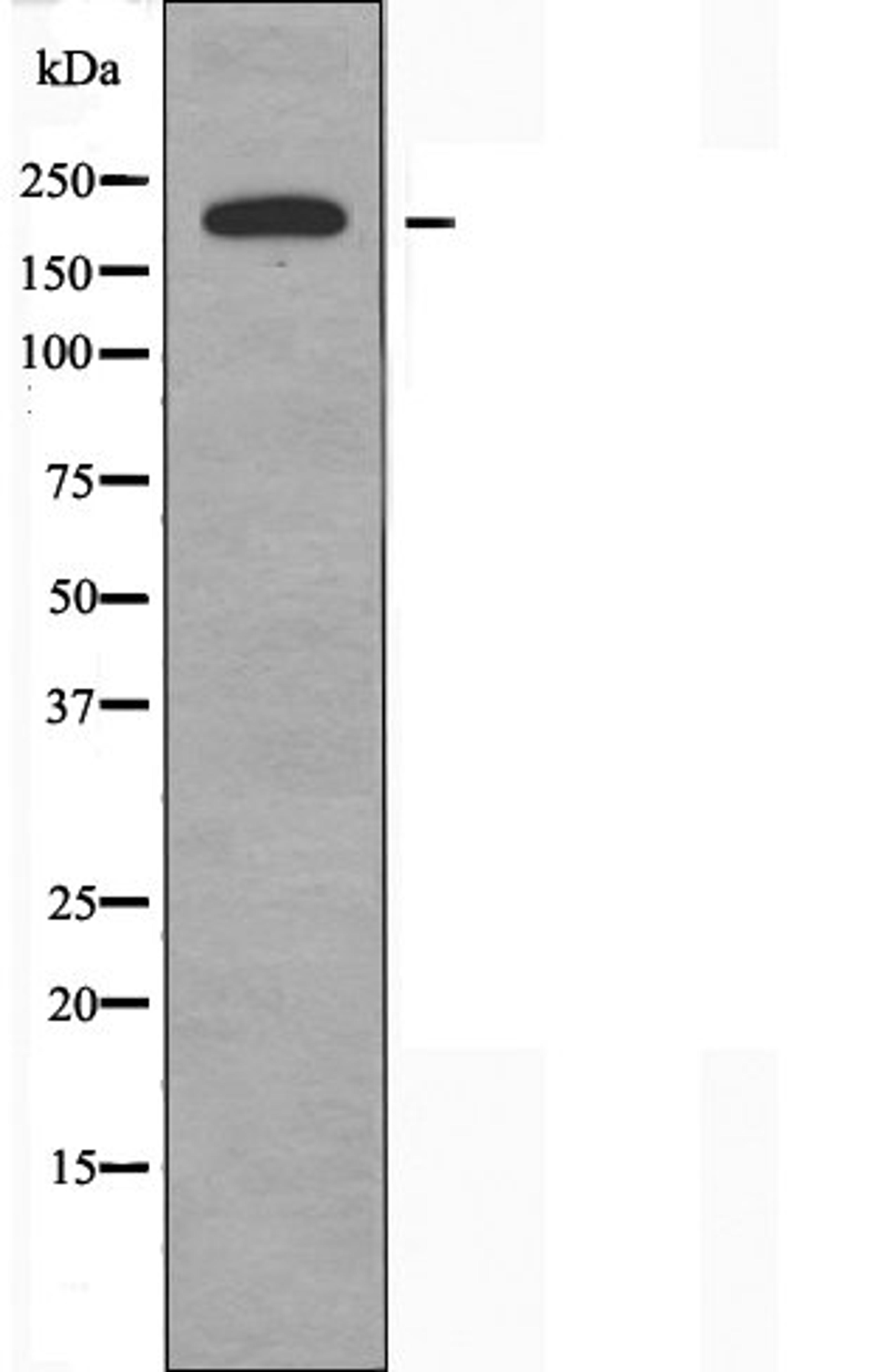 Western blot analysis of Hela cells using Collagen V Alpha1 antibody