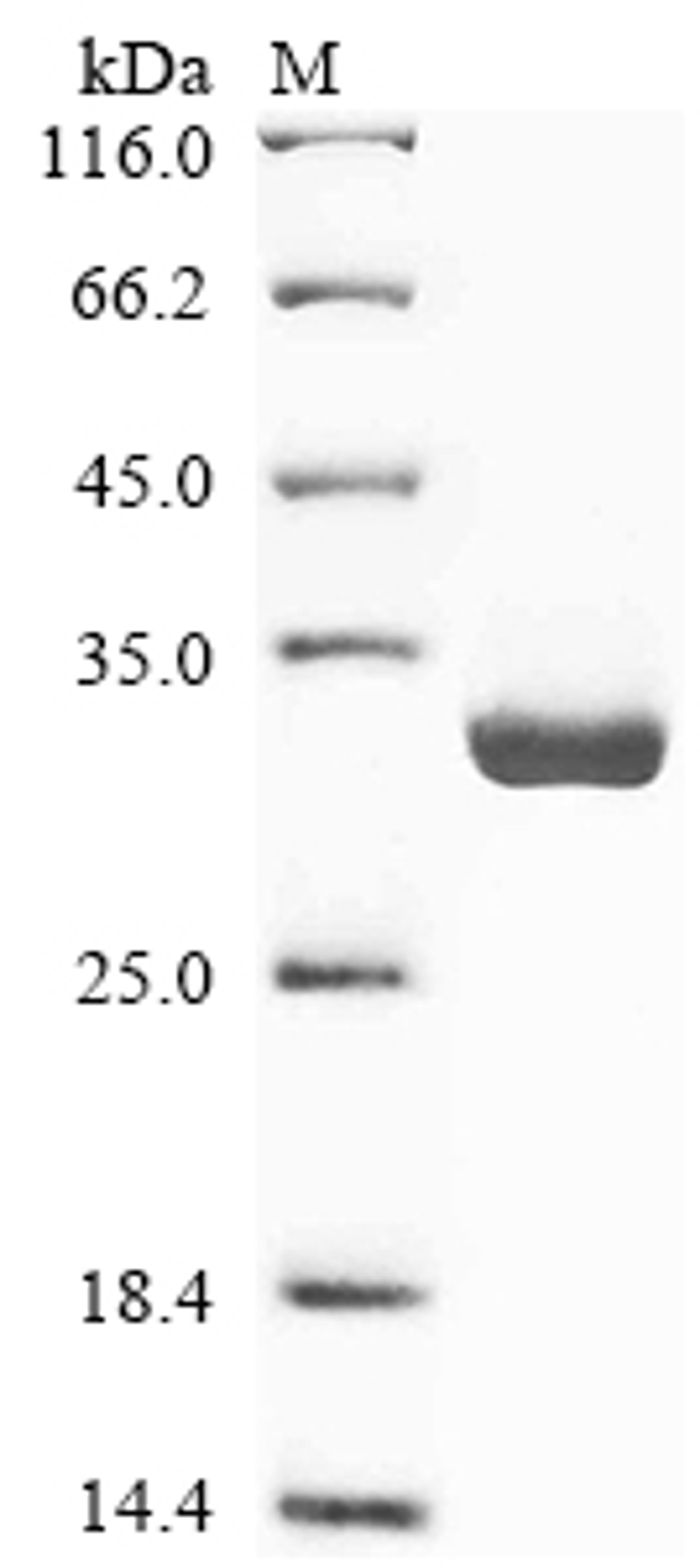 (Tris-Glycine gel) Discontinuous SDS-PAGE (reduced) with 5% enrichment gel and 15% separation gel.