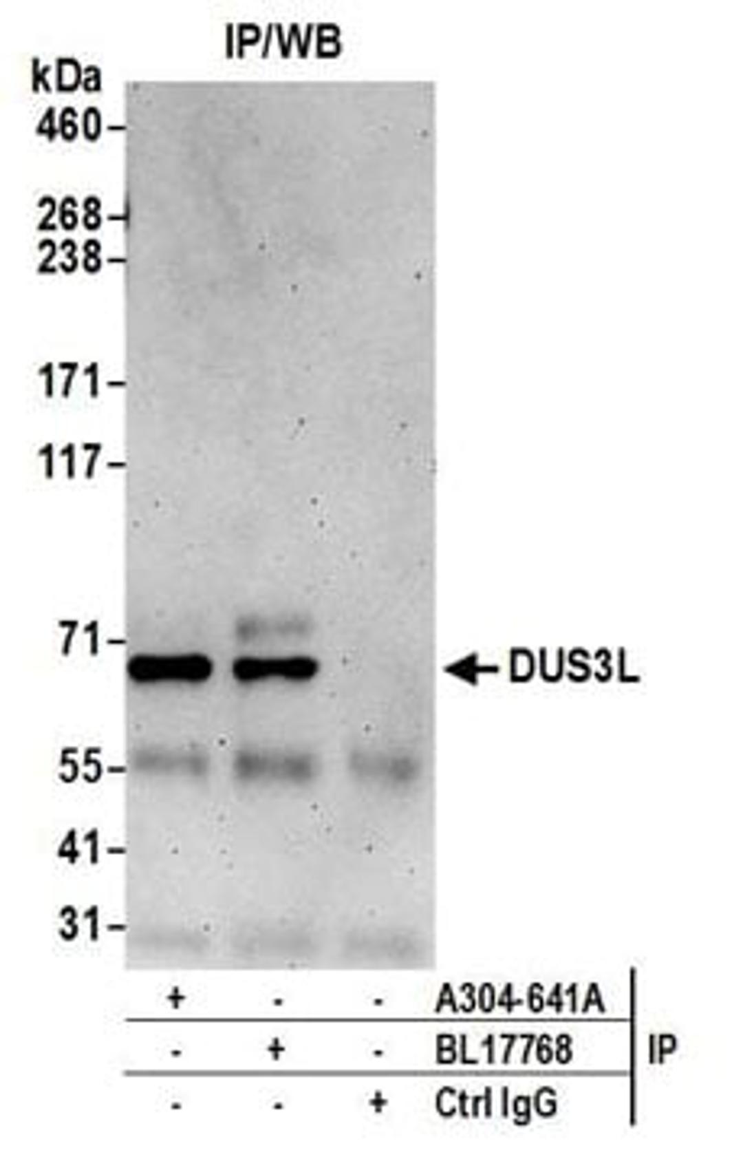 Detection of human DUS3L by western blot of immunoprecipitates.