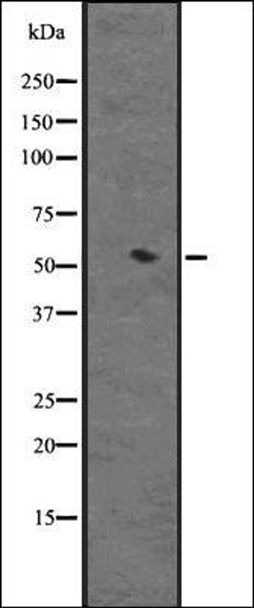 Western blot analysis of HEK293 cells using Cytochrome P450 3A4 antibody