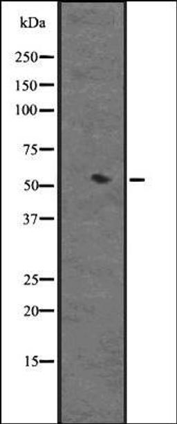 Western blot analysis of HEK293 cells using Cytochrome P450 3A4 antibody