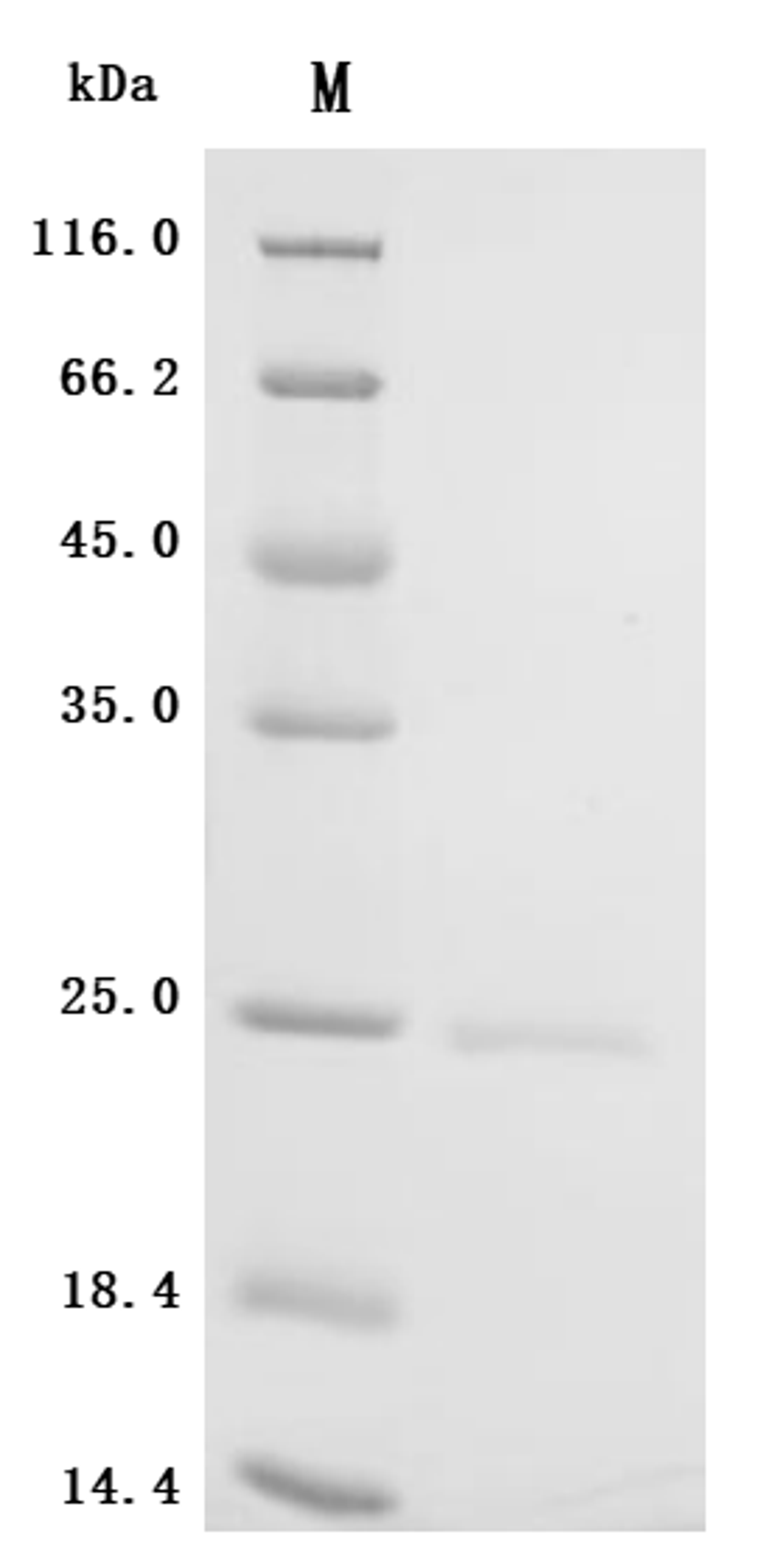 (Tris-Glycine gel) Discontinuous SDS-PAGE (reduced) with 5% enrichment gel and 15% separation gel.