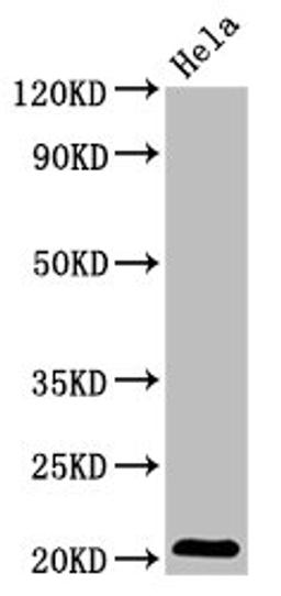 Western Blot. Positive WB detected in: Hela whole cell lysate. All lanes: ARL1 antibody at 5.1µg/ml. Secondary. Goat polyclonal to rabbit IgG at 1/50000 dilution. Predicted band size: 21, 19 kDa. Observed band size: 21 kDa