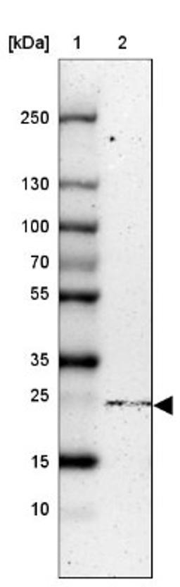 Western Blot: NTPCR Antibody [NBP1-88331] - Lane 1: Marker [kDa] 250, 130, 100, 70, 55, 35, 25, 15, 10<br/>Lane 2: HEK 293