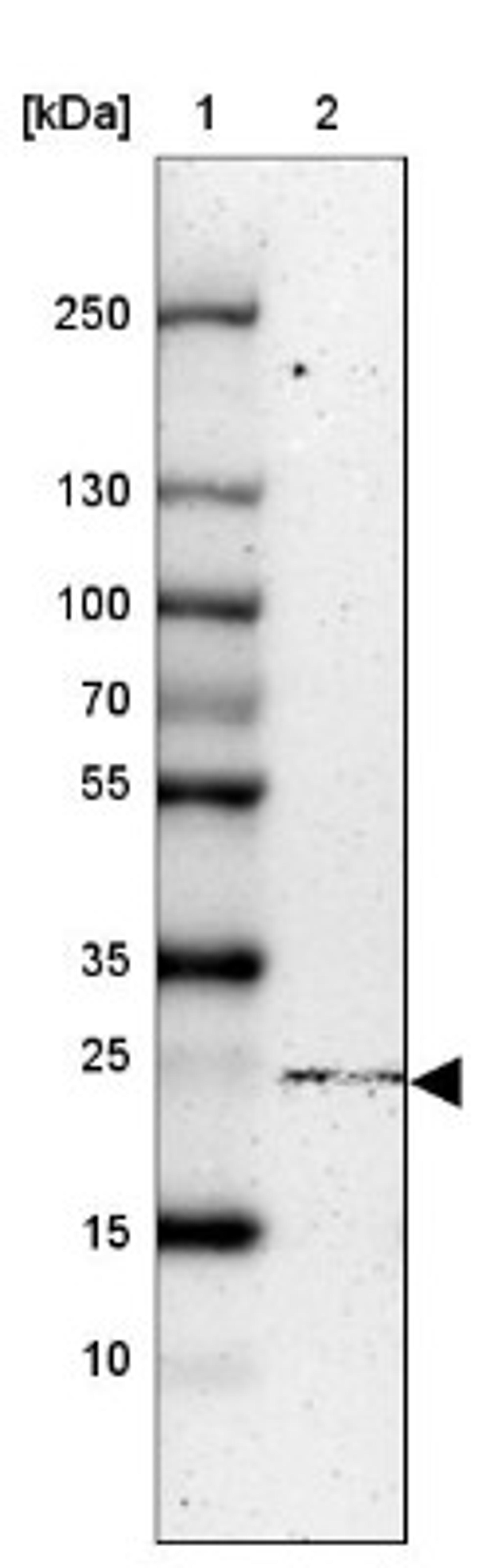 Western Blot: NTPCR Antibody [NBP1-88331] - Lane 1: Marker [kDa] 250, 130, 100, 70, 55, 35, 25, 15, 10<br/>Lane 2: HEK 293