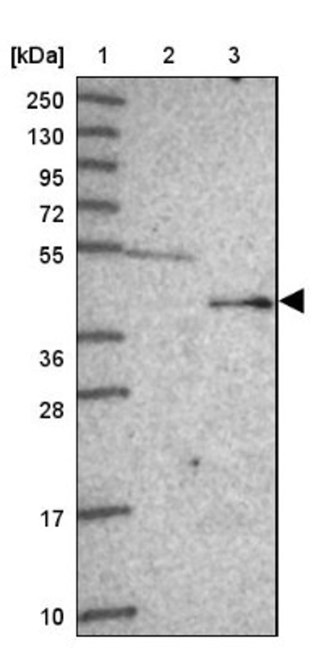 Western Blot: FECH Antibody [NBP2-33413] - Lane 1: Marker [kDa] 250, 130, 95, 72, 55, 36, 28, 17, 10<br/>Lane 2: Human cell line RT-4<br/>Lane 3: Human cell line U-251MG