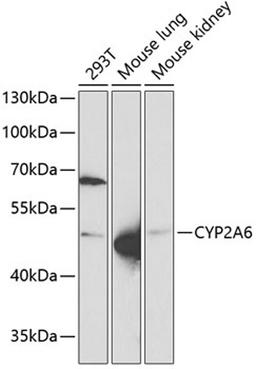 Western blot - CYP2A6 Antibody (A5815)