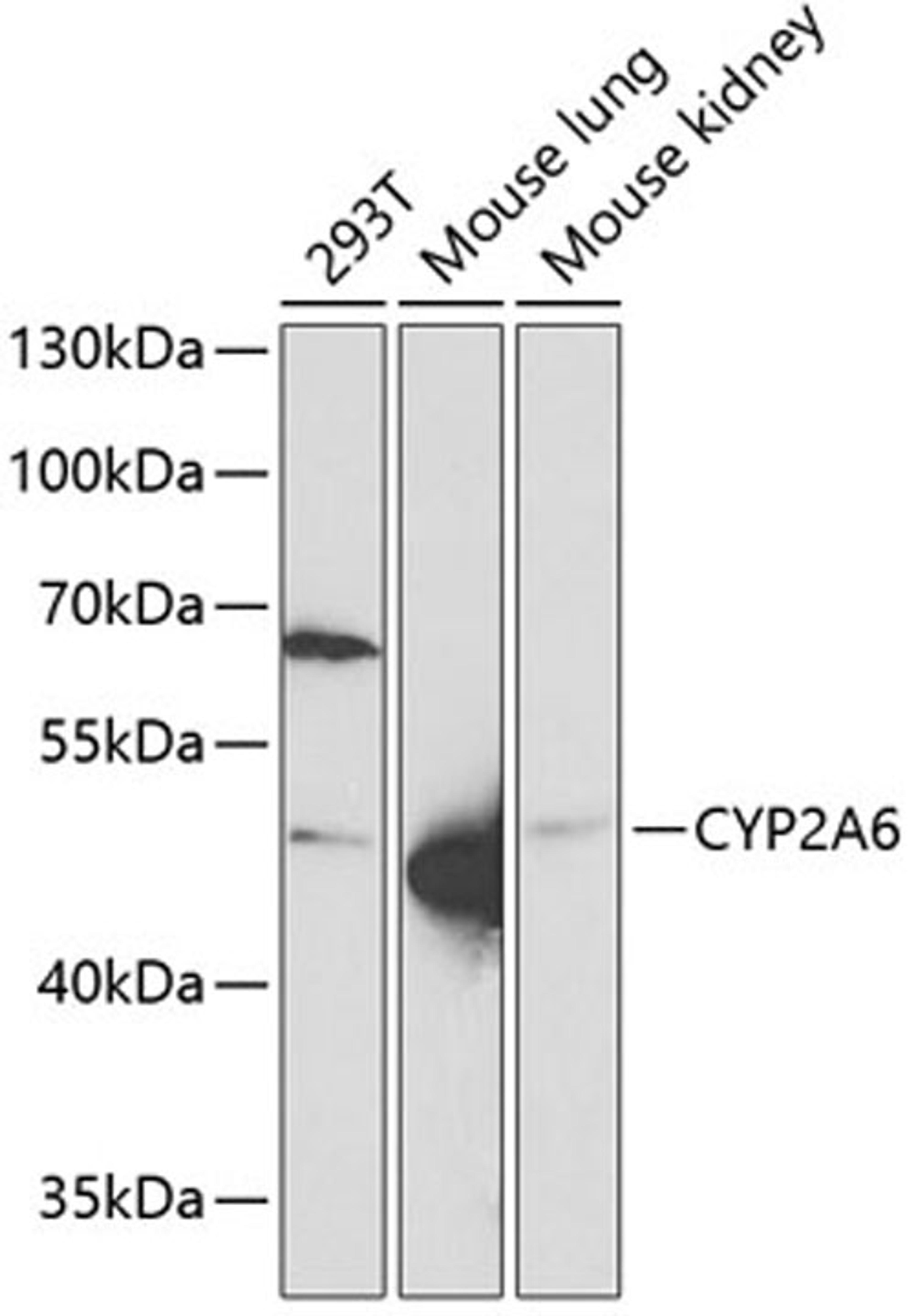 Western blot - CYP2A6 Antibody (A5815)