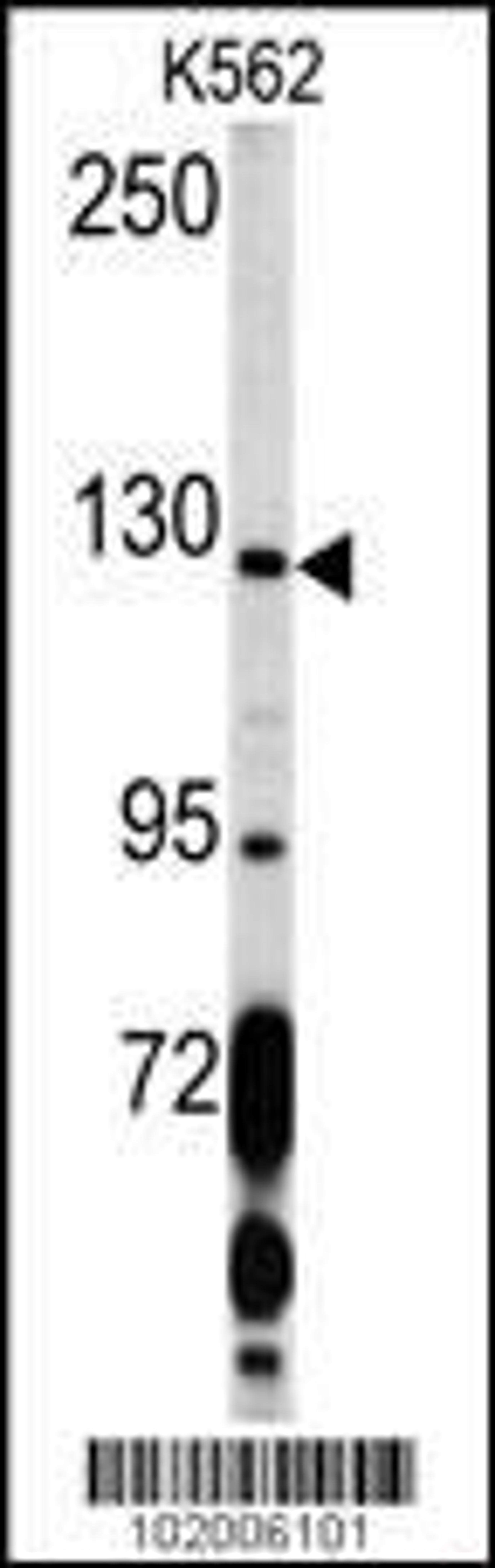 Western blot analysis of PDGFRA Antibody (C-term E1063) in K562 cell line lysates (35ug/lane)