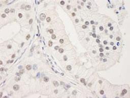 Detection of human UACA by immunohistochemistry.