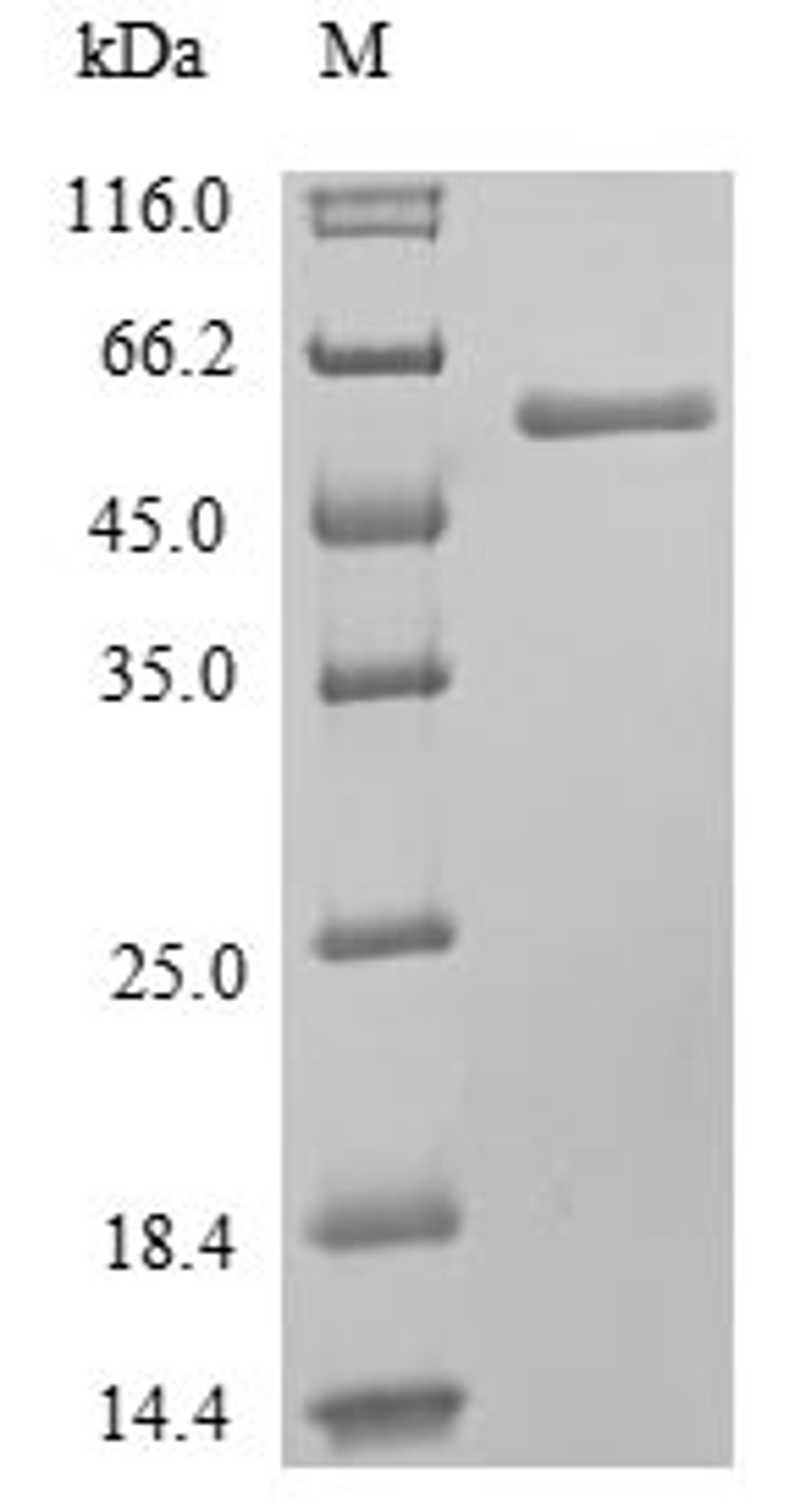 (Tris-Glycine gel) Discontinuous SDS-PAGE (reduced) with 5% enrichment gel and 15% separation gel.