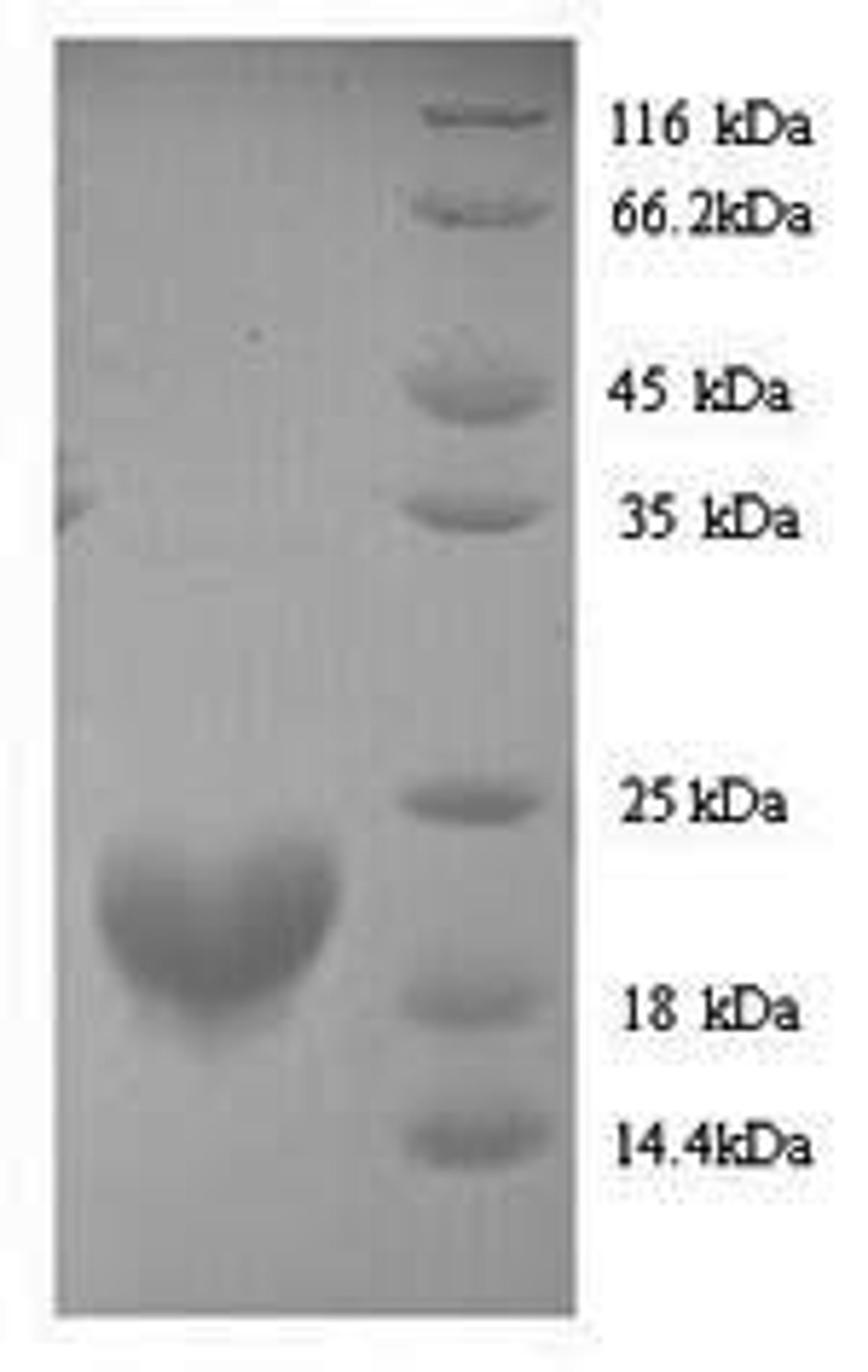 (Tris-Glycine gel) Discontinuous SDS-PAGE (reduced) with 5% enrichment gel and 15% separation gel.