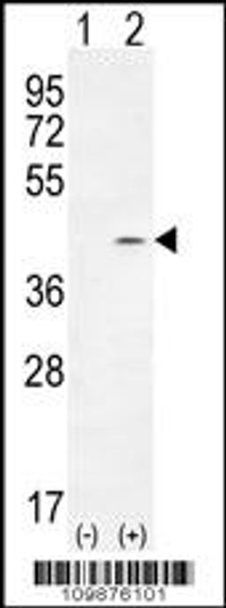 Western blot analysis of PTK9L using rabbit polyclonal PTK9L Antibody using 293 cell lysates (2 ug/lane) either nontransfected (Lane 1) or transiently transfected (Lane 2) with the PTK9L gene.