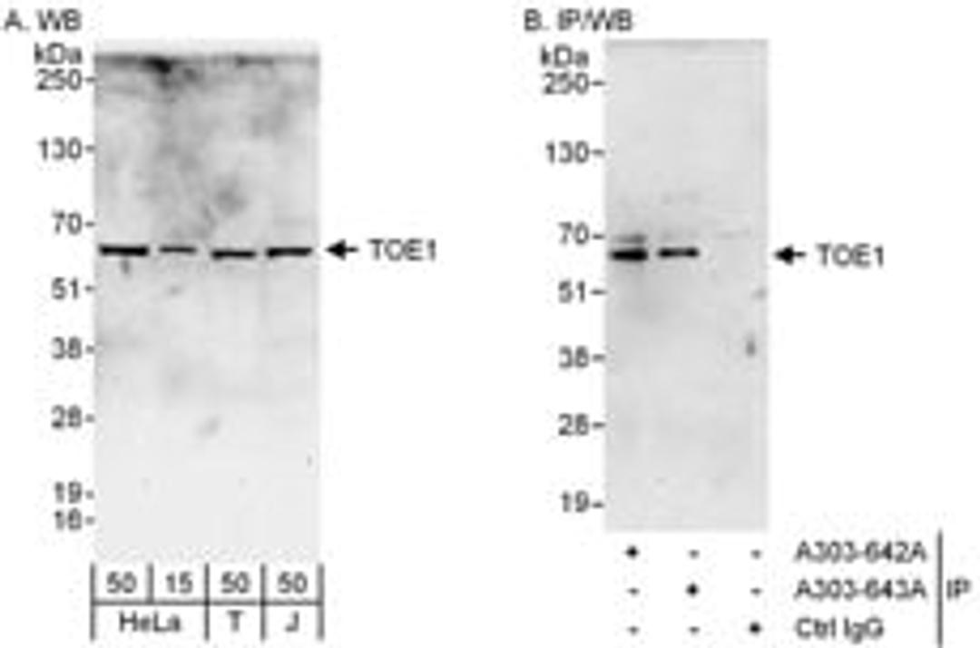 Detection of human TOE1 by western blot and immunoprecipitation.