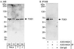 Detection of human TOE1 by western blot and immunoprecipitation.