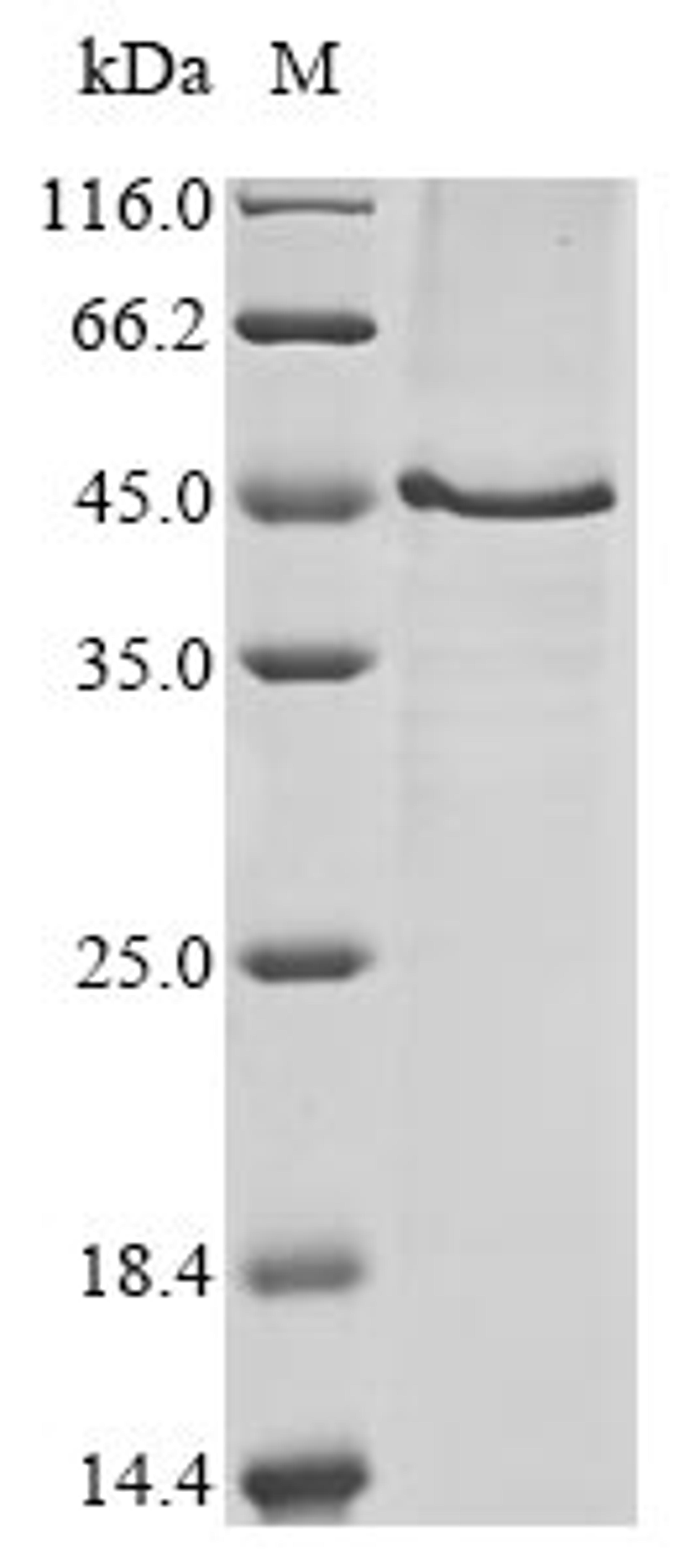 (Tris-Glycine gel) Discontinuous SDS-PAGE (reduced) with 5% enrichment gel and 15% separation gel.