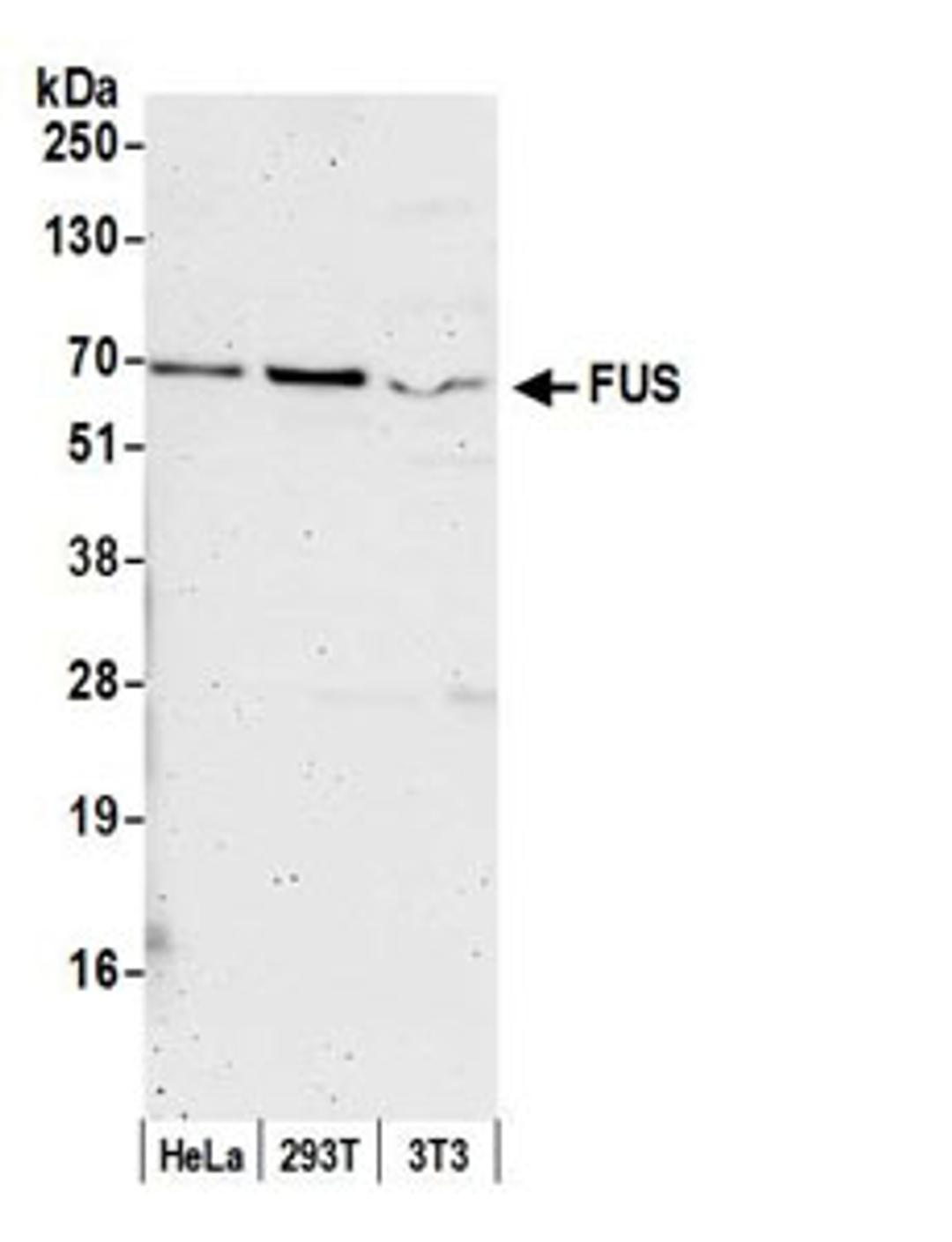 Detection of human and mouse FUS by western blot.