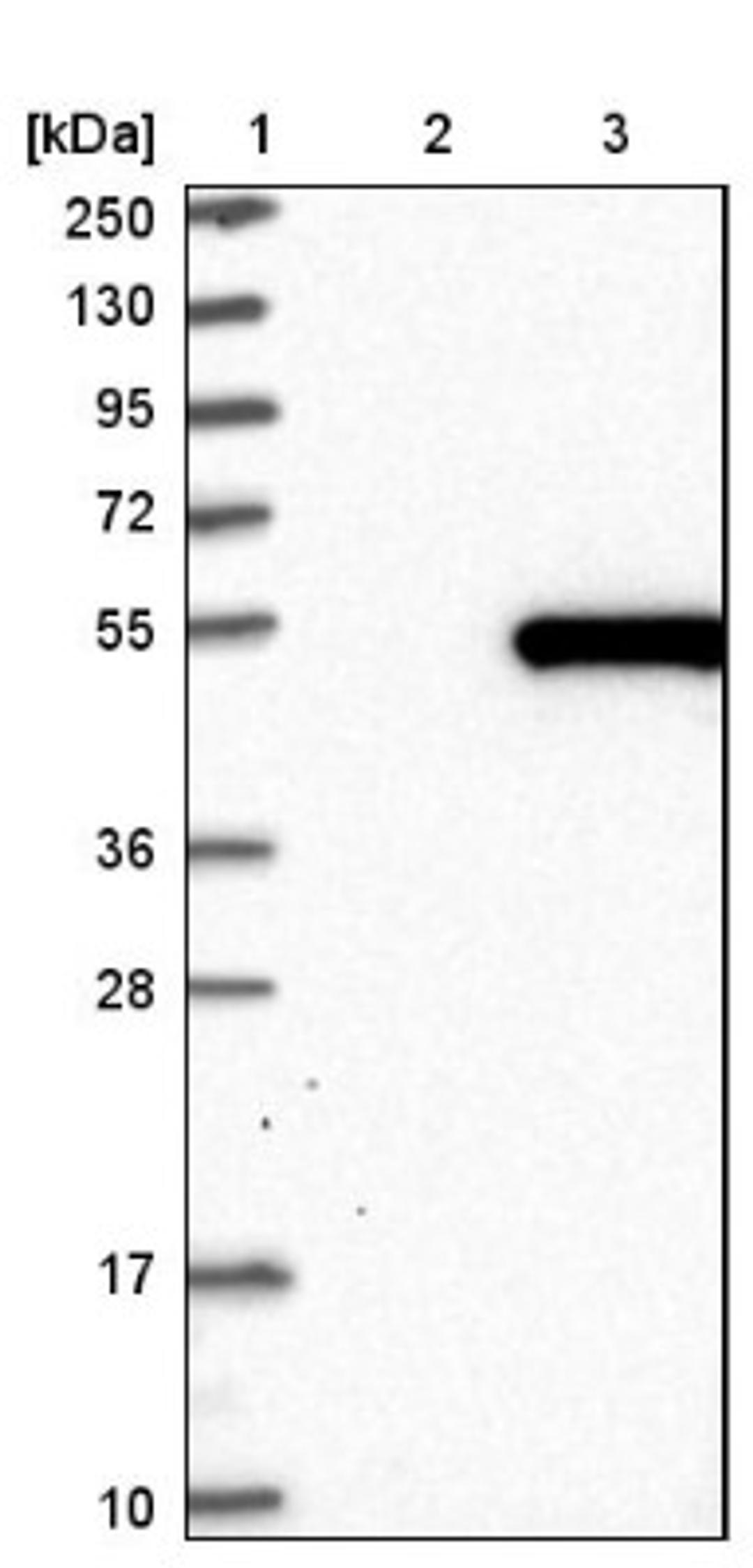 Western Blot: LRRC2 Antibody [NBP1-86250] - Lane 1: Marker [kDa] 250, 130, 95, 72, 55, 36, 28, 17, 10<br/>Lane 2: Negative control (vector only transfected HEK293T lysate)<br/>Lane 3: Over-expression lysate (Co-expressed with a C-terminal myc-DDK tag (~3.1 kDa) in mammalian HEK293T cells, LY411101)