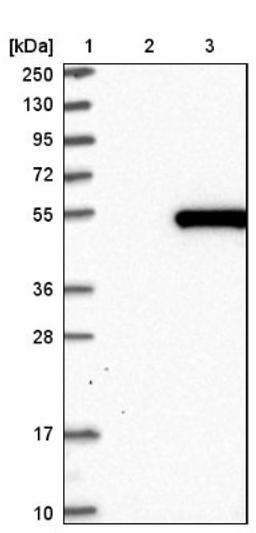 Western Blot: LRRC2 Antibody [NBP1-86250] - Lane 1: Marker [kDa] 250, 130, 95, 72, 55, 36, 28, 17, 10<br/>Lane 2: Negative control (vector only transfected HEK293T lysate)<br/>Lane 3: Over-expression lysate (Co-expressed with a C-terminal myc-DDK tag (~3.1 kDa) in mammalian HEK293T cells, LY411101)