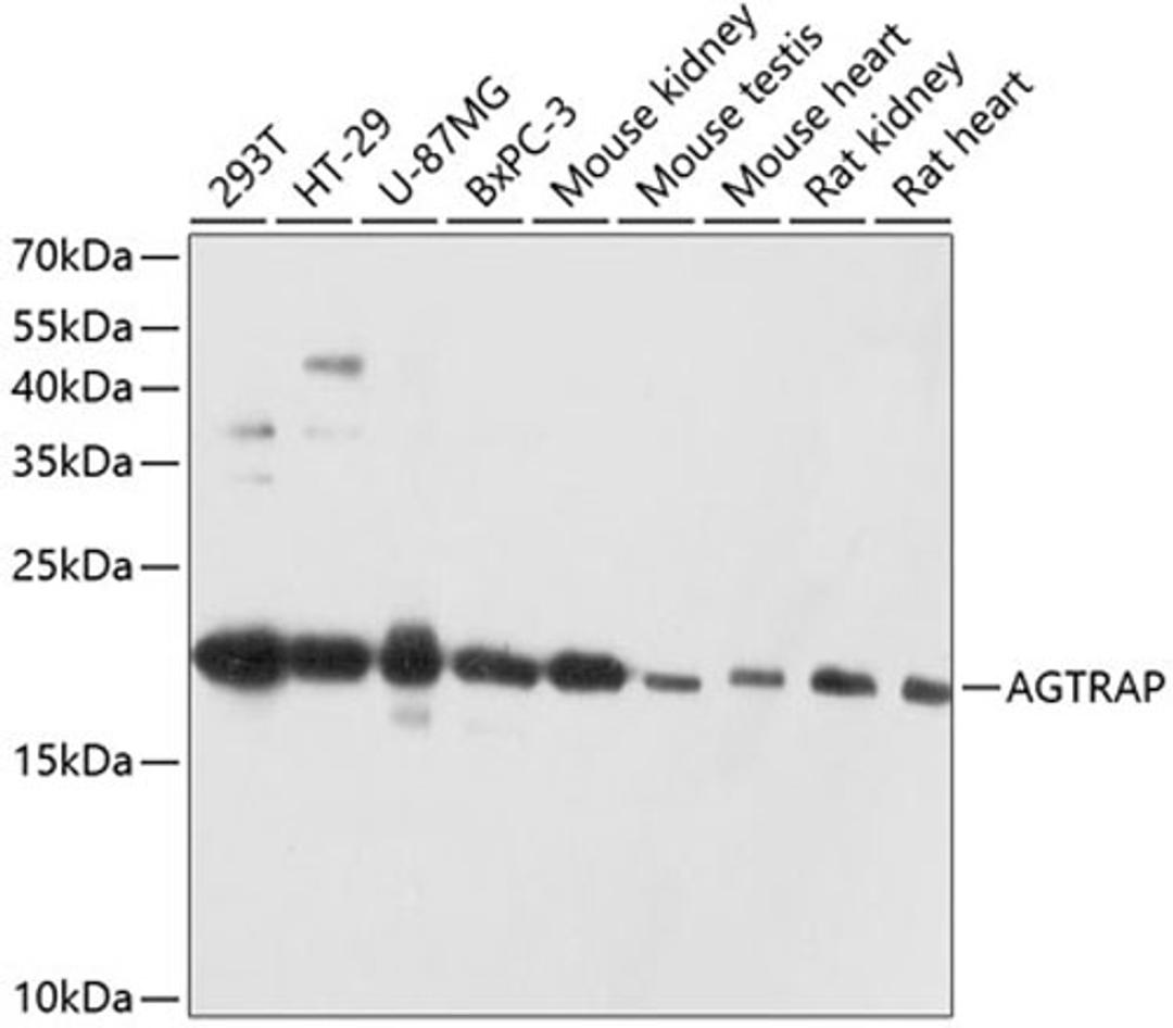 Western blot - AGTRAP antibody (A12178)