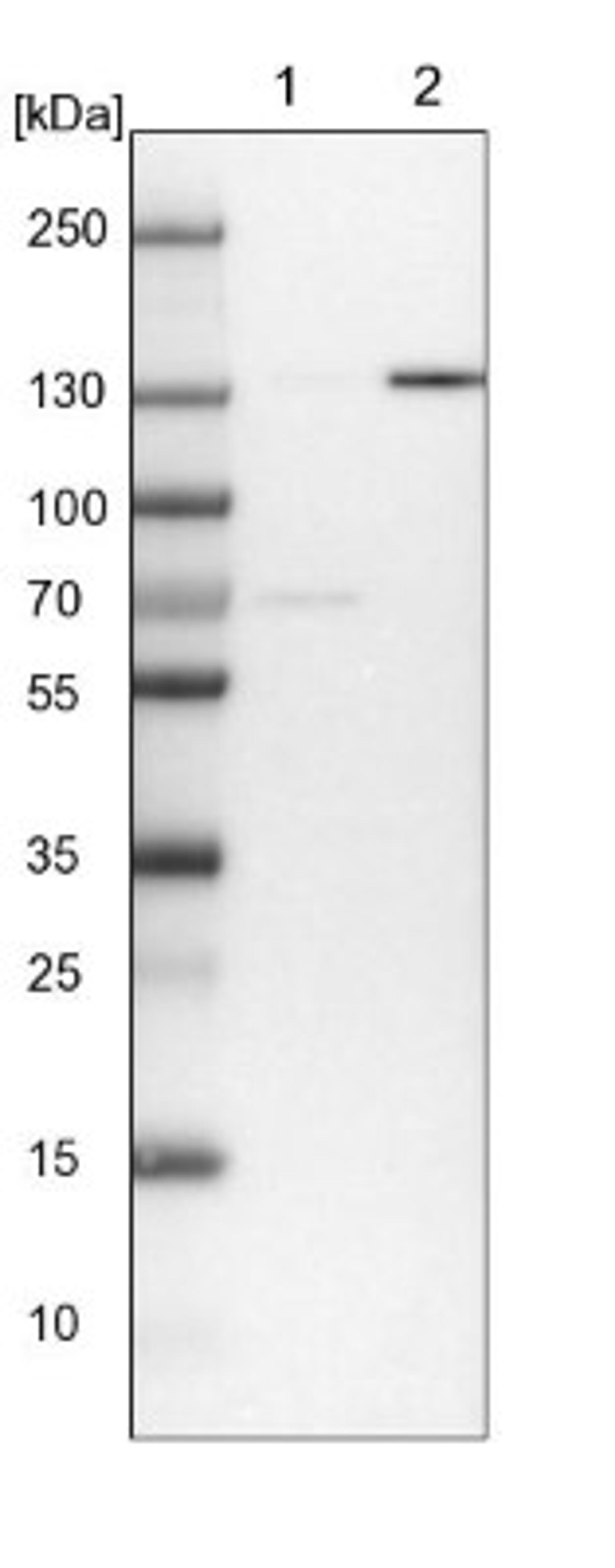 Western Blot: CNKR2 Antibody [NBP1-88065] - Lane 1: NIH-3T3 cell lysate (Mouse embryonic fibroblast cells)<br/>Lane 2: NBT-II cell lysate (Rat Wistar bladder tumour cells)