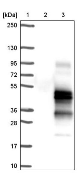 Western Blot: TMEM139 Antibody [NBP1-83439] - Lane 1: Marker [kDa] 250, 130, 95, 72, 55, 36, 28, 17, 10<br/>Lane 2: Negative control (vector only transfected HEK293T lysate)<br/>Lane 3: Over-expression lysate (Co-expressed with a C-terminal myc-DDK tag (~3.1 kDa) in mammalian HEK293T cells, LY407062)