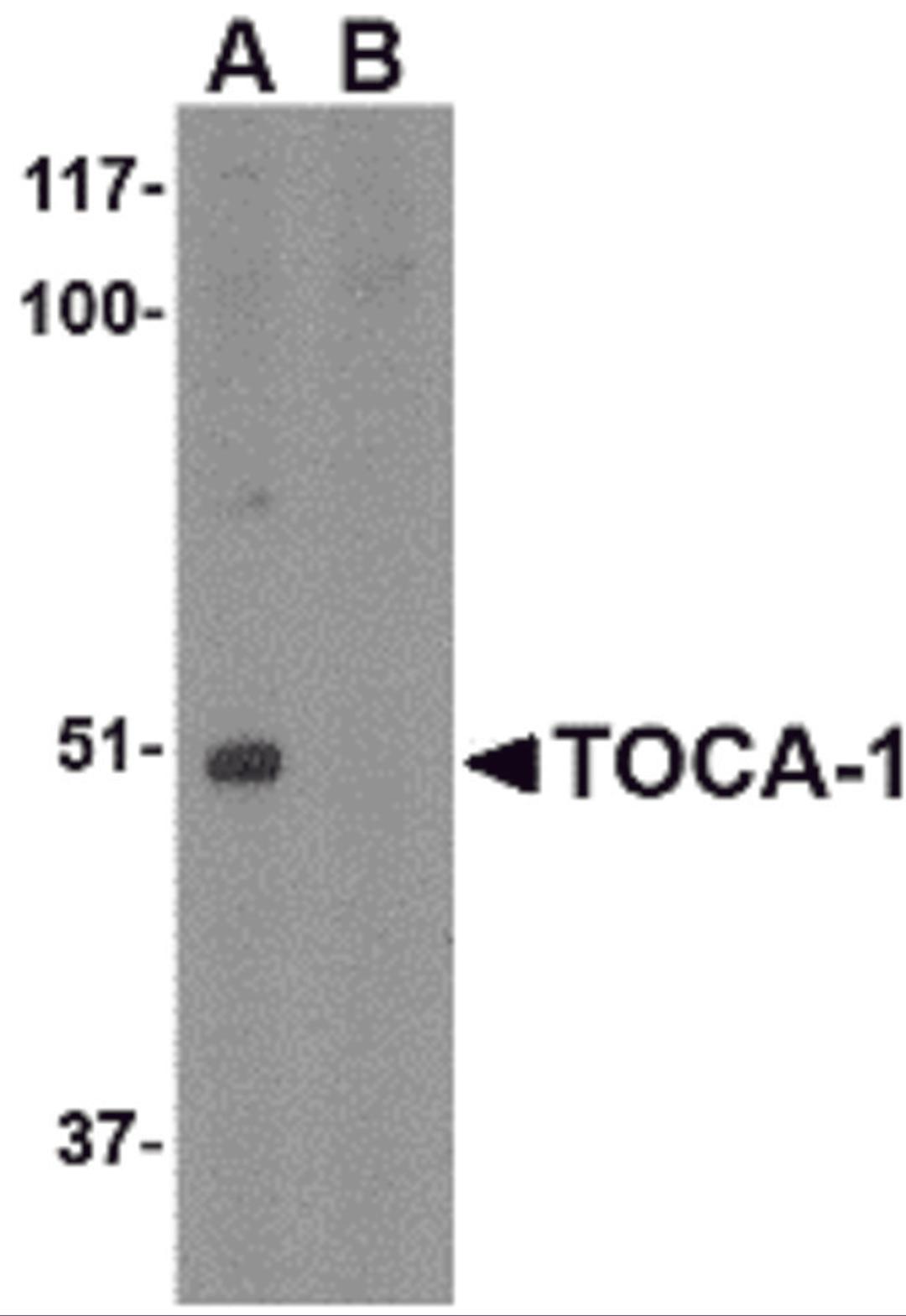 Western blot analysis of TOCA-1 in mouse brain tissue lysate with in (A) the absence and (B) the presence of blocking peptide with TOCA-1 antibody at 1 μg/mL.