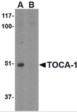 Western blot analysis of TOCA-1 in mouse brain tissue lysate with in (A) the absence and (B) the presence of blocking peptide with TOCA-1 antibody at 1 μg/mL.