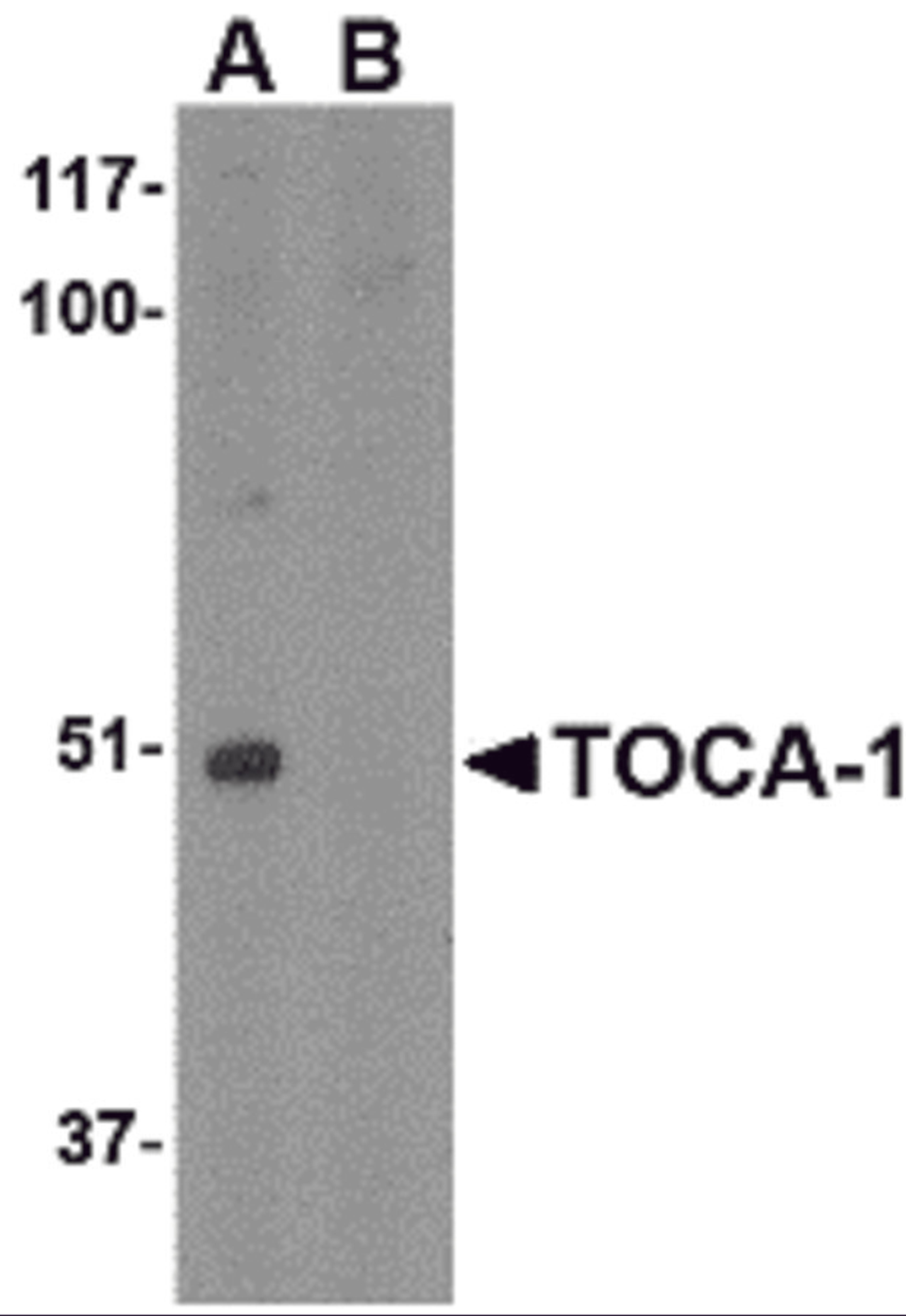 Western blot analysis of TOCA-1 in mouse brain tissue lysate with in (A) the absence and (B) the presence of blocking peptide with TOCA-1 antibody at 1 μg/mL.