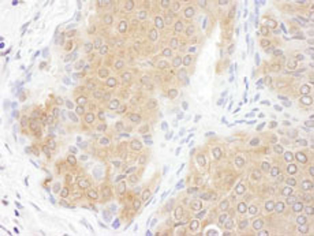 Detection of human CCT3 by immunohistochemistry.