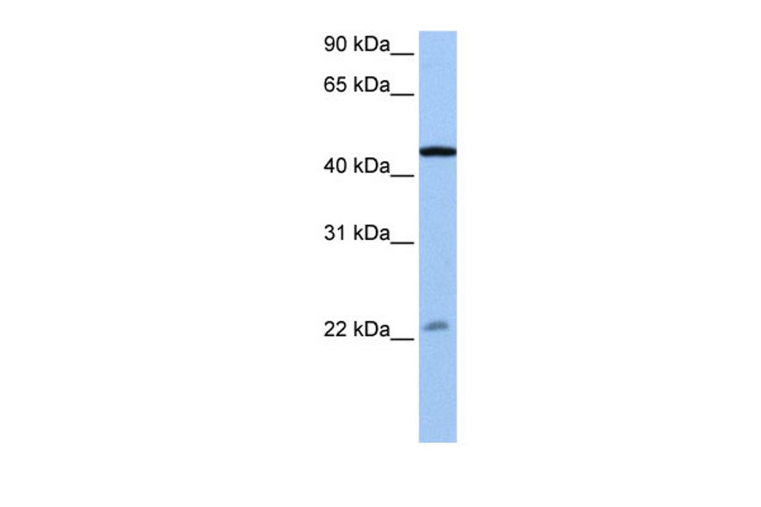 Antibody used in WB on Human Jurkat cells at 0.2-1 ug/ml.