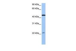 Antibody used in WB on Human Jurkat cells at 0.2-1 ug/ml.