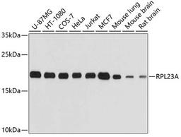 Western blot - RPL23A antibody (A4086)