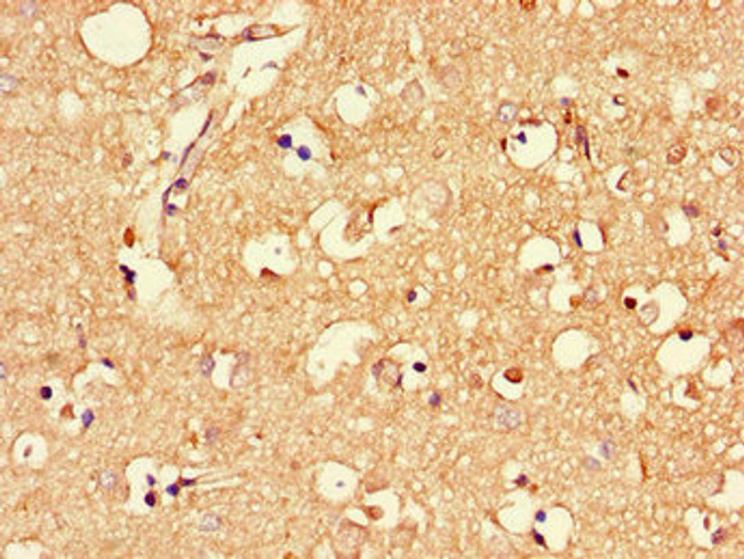 Immunohistochemistry of paraffin-embedded human brain tissue using CSB-PA613581LA01HU at dilution of 1:100