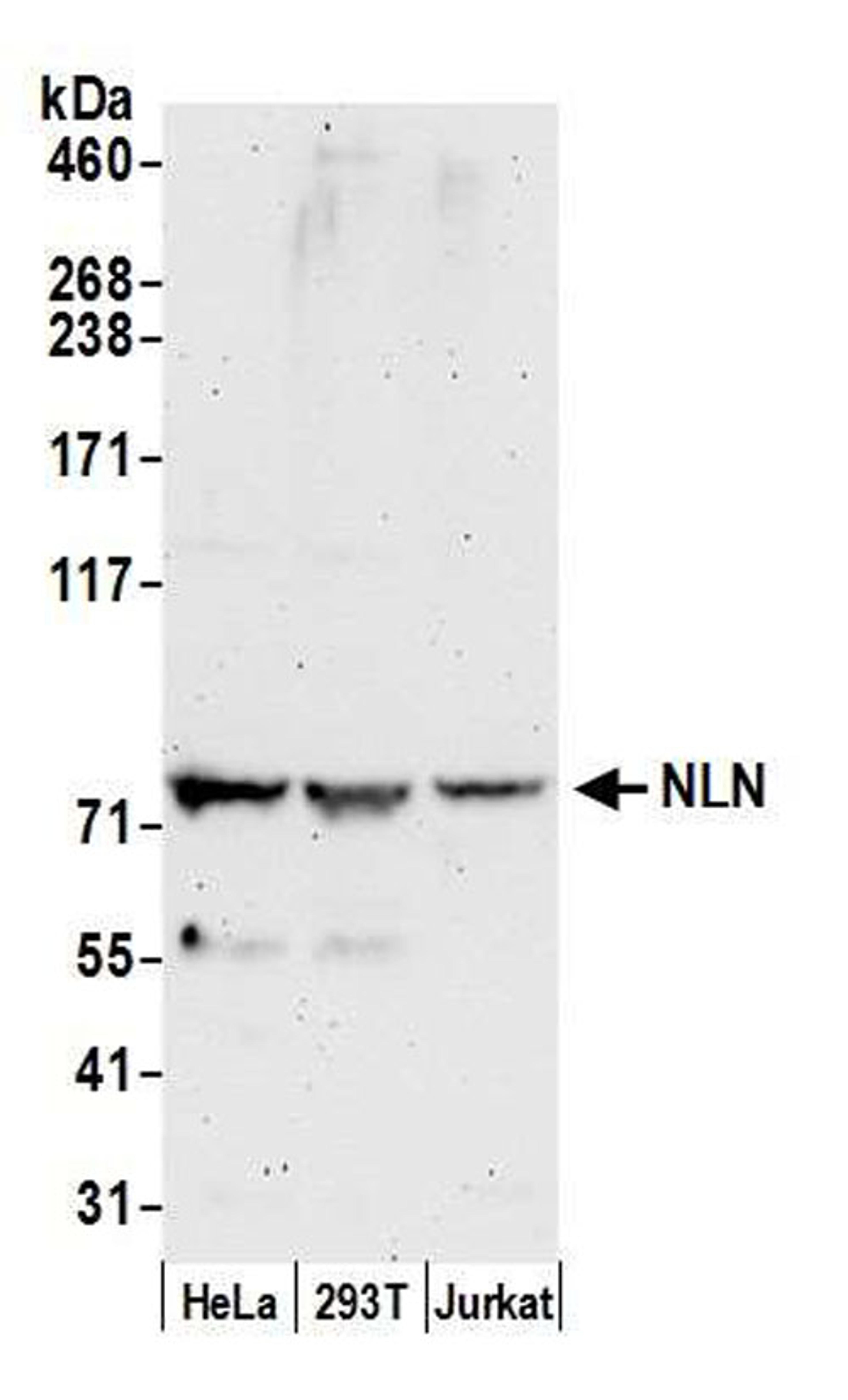 Detection of human NLN by WB.