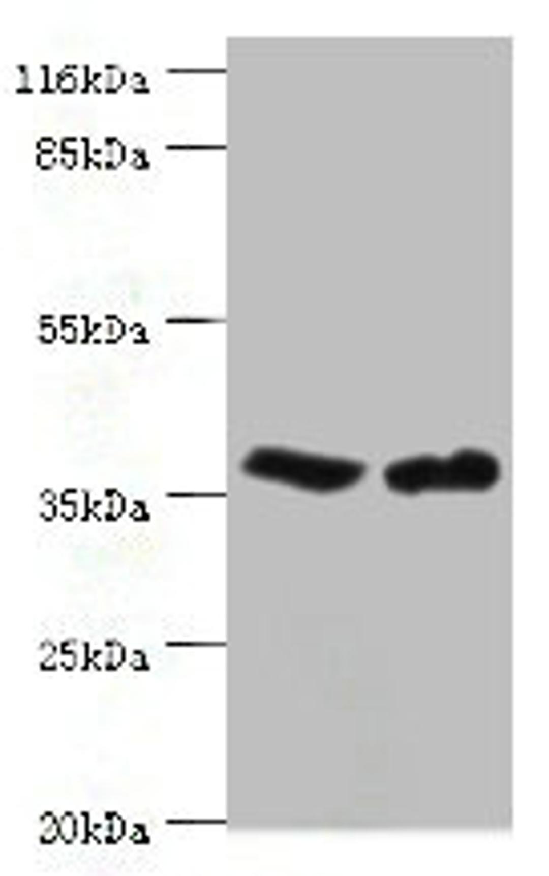 Western blot. All lanes: CA5B antibody at 2ug/ml. Lane 1: Mouse liver tissue. Lane 2: Mouse kidney tissue. Secondary. Goat polyclonal to rabbit IgG at 1/10000 dilution. Predicted band size: 36 kDa. Observed band size: 36 kDa. 