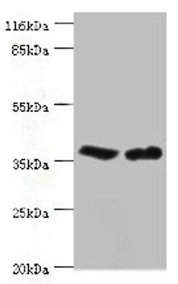 Western blot. All lanes: CA5B antibody at 2ug/ml. Lane 1: Mouse liver tissue. Lane 2: Mouse kidney tissue. Secondary. Goat polyclonal to rabbit IgG at 1/10000 dilution. Predicted band size: 36 kDa. Observed band size: 36 kDa. 
