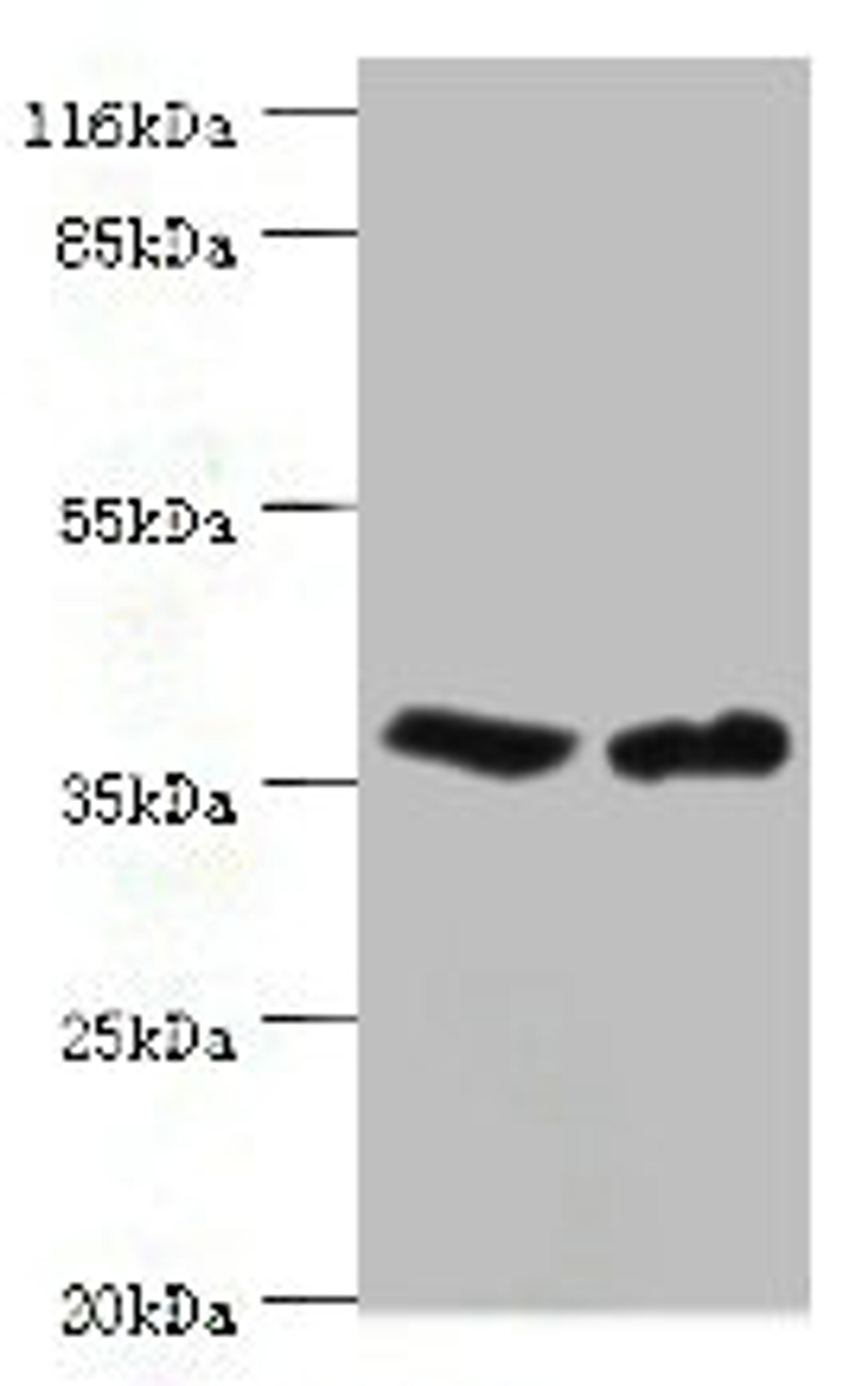 Western blot. All lanes: CA5B antibody at 2ug/ml. Lane 1: Mouse liver tissue. Lane 2: Mouse kidney tissue. Secondary. Goat polyclonal to rabbit IgG at 1/10000 dilution. Predicted band size: 36 kDa. Observed band size: 36 kDa. 