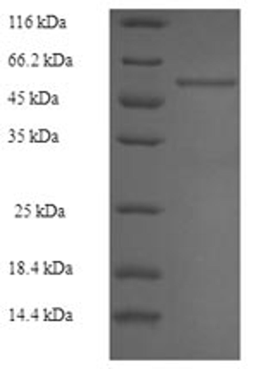 (Tris-Glycine gel) Discontinuous SDS-PAGE (reduced) with 5% enrichment gel and 15% separation gel.