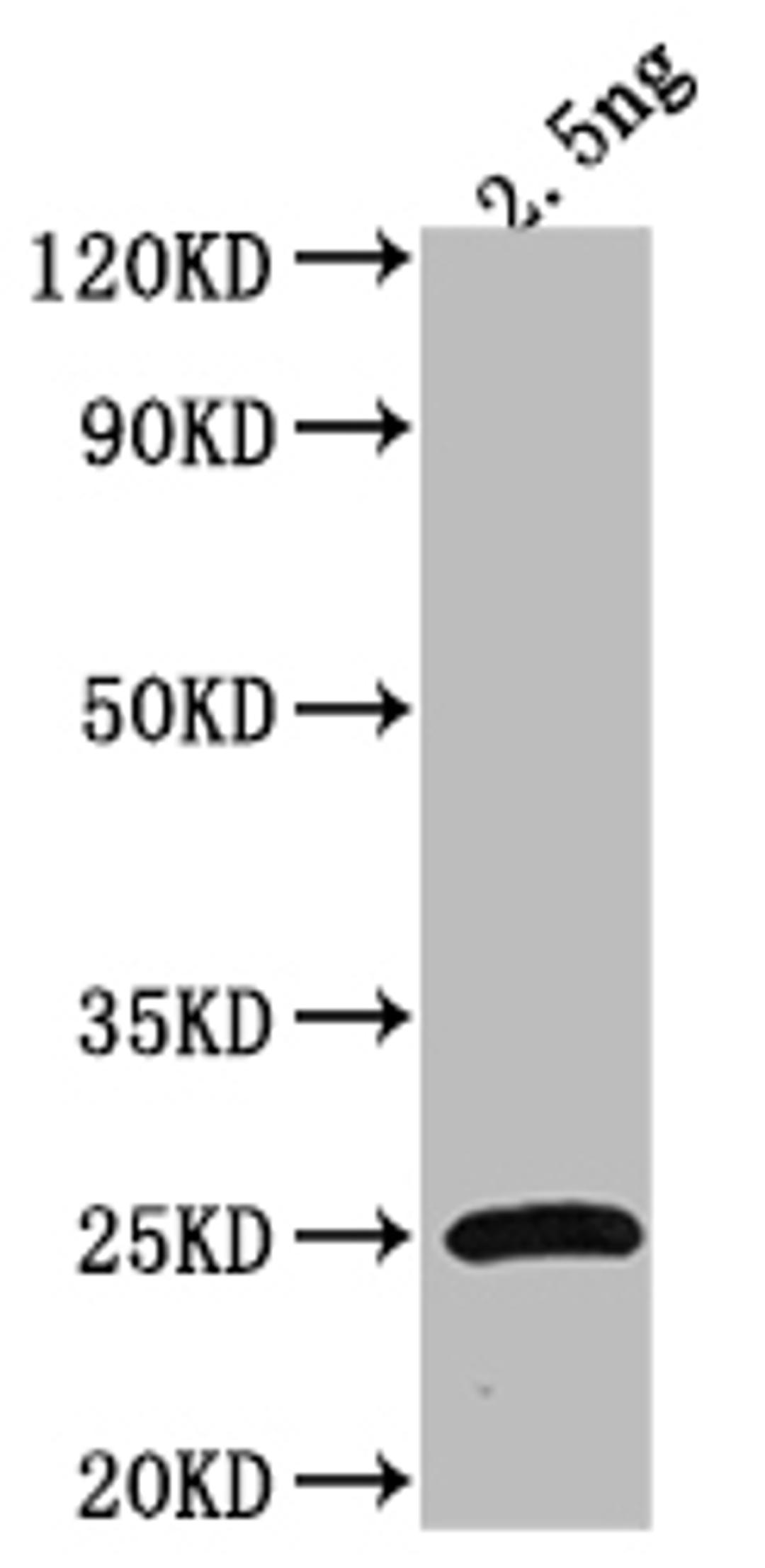 Western Blot. Positive WB detected in Recombinant protein. All lanes: Tet antibody at 1:2000. Secondary. Goat polyclonal to rabbit IgG at 1/50000 dilution. Predicted band size: 25.5 kDa. Observed band size: 23 kDa.
