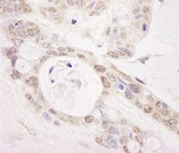 Detection of human PUS1 by immunohistochemistry.