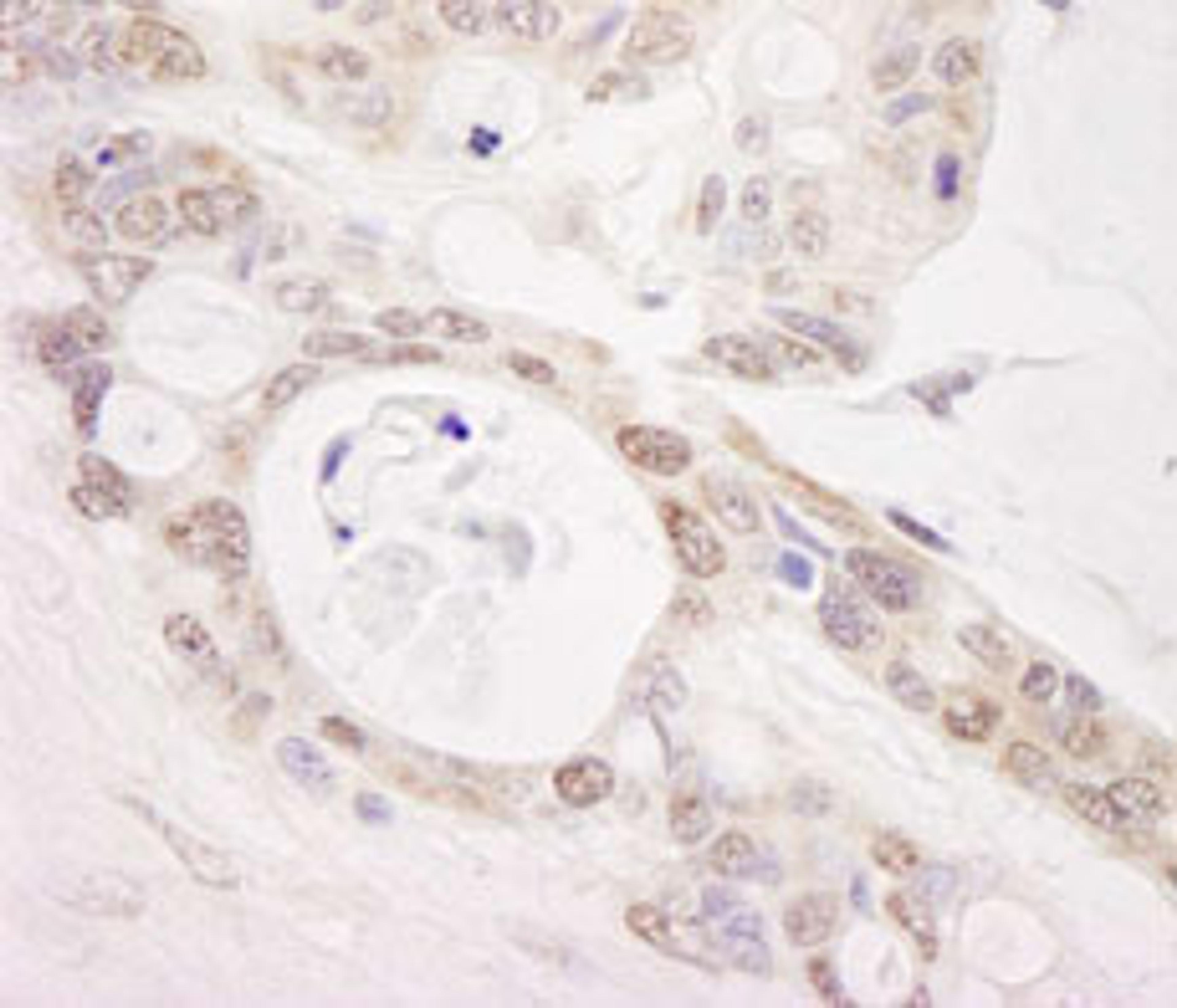 Detection of human PUS1 by immunohistochemistry.