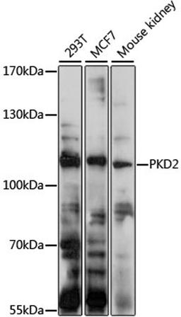 Western blot - PKD2 antibody (A3625)
