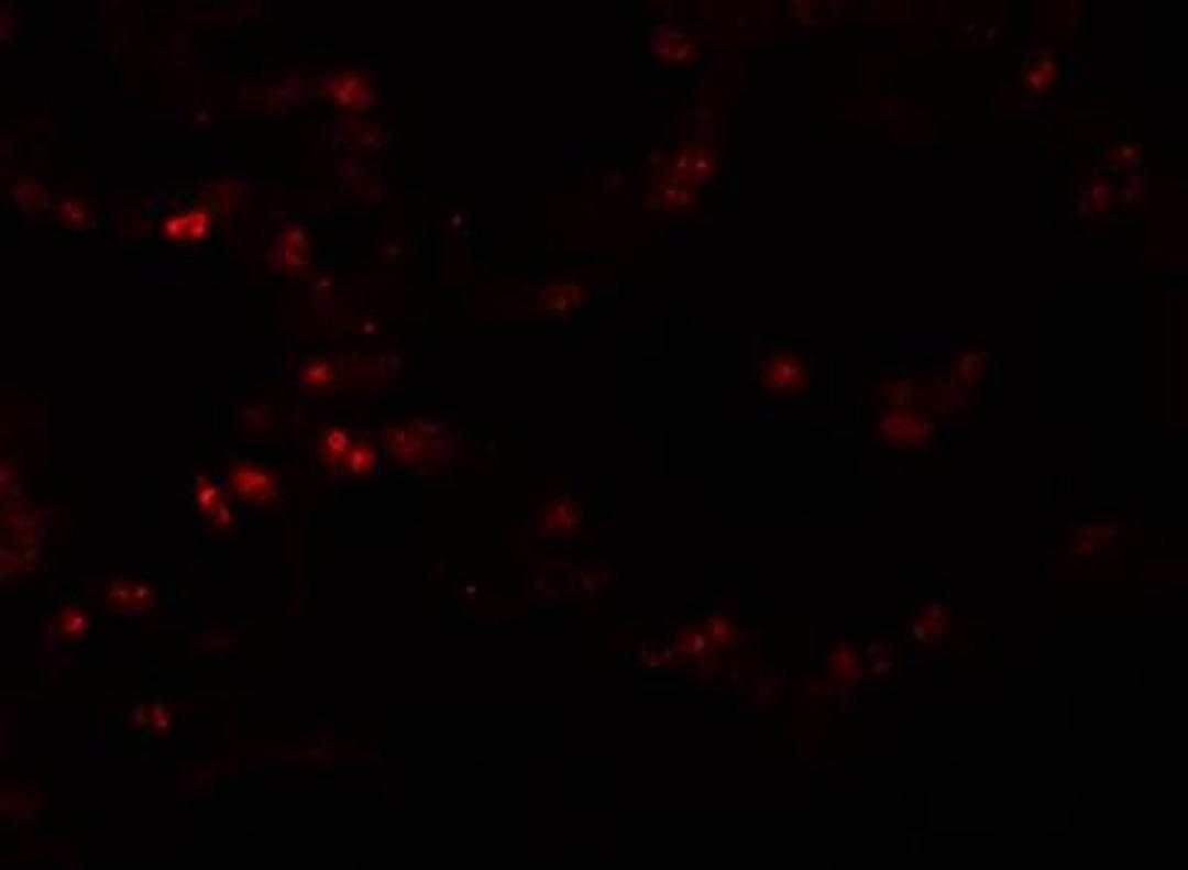 Immunocytochemistry/Immunofluorescence: TMEM184B Antibody [NBP1-77143] - Immunofluorescence of TMEM184B in human lung tissue with TMEM184B antibody at 20 ug/mL.