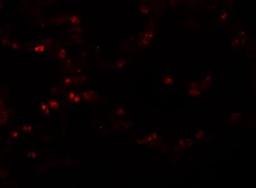 Immunocytochemistry/Immunofluorescence: TMEM184B Antibody [NBP1-77143] - Immunofluorescence of TMEM184B in human lung tissue with TMEM184B antibody at 20 ug/mL.