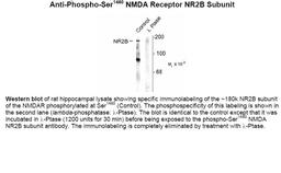 Western blot of rat hippocampal lysate showing specific immunolabeling of the ~180k NR2B subunit of the NMDAR phosphorylated at Ser1480 (Control). The phosphospecificity of this labeling is shown in the second lane (lambda-phosphatase: lamda-Ptase). The b