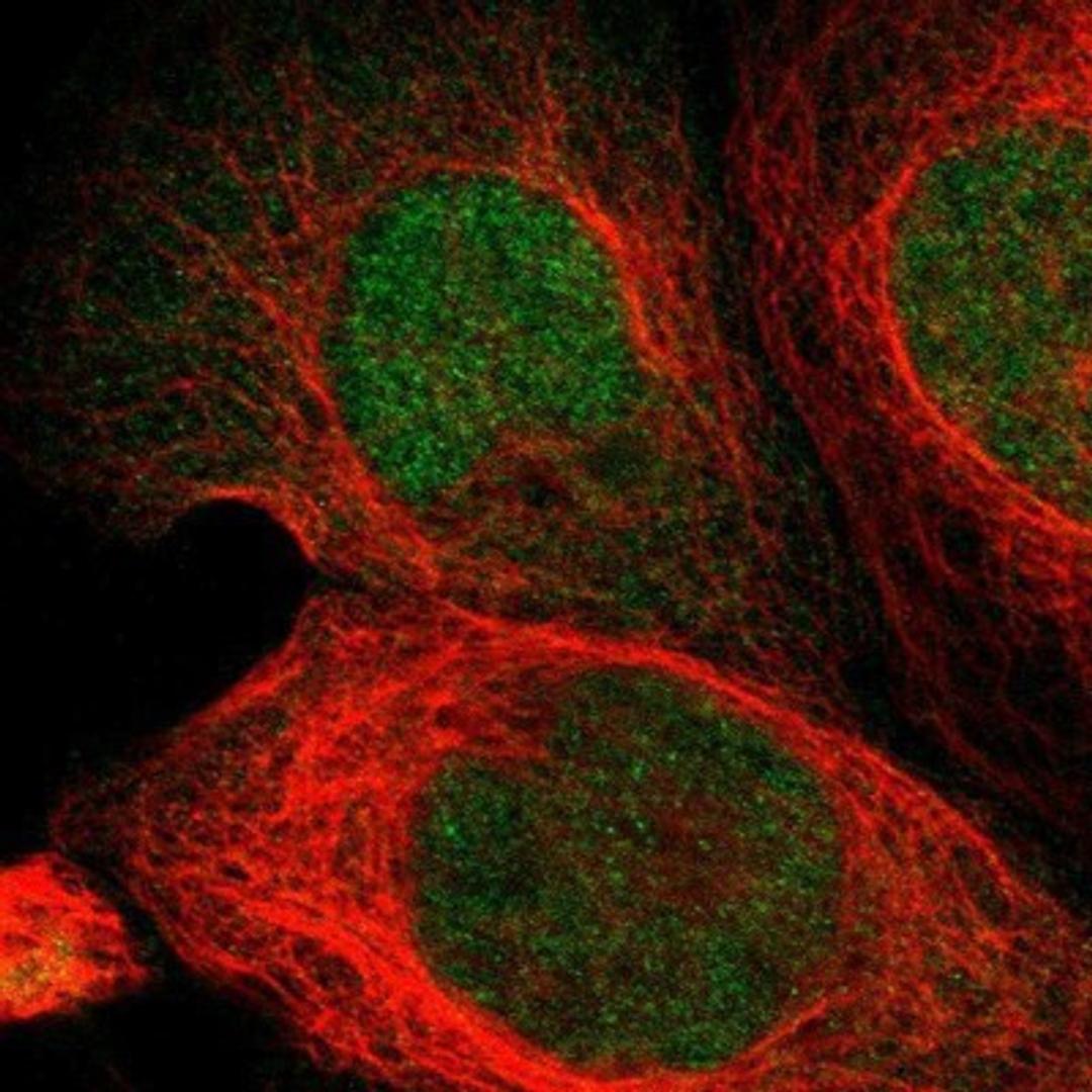 Immunocytochemistry/Immunofluorescence: PTPN6 Antibody [NBP1-83276] - Staining of human cell line A-431 shows positivity in nucleus & cytoplasm.